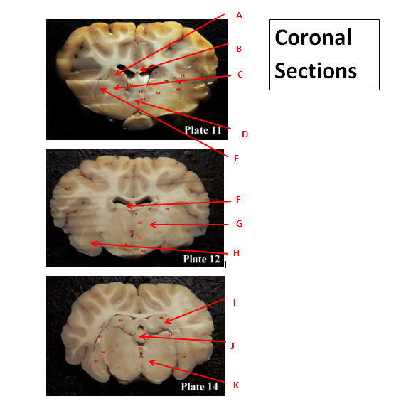 Sheep Brain Neuroanatomy Online Self-Test | Kwantlen Polytechnic University